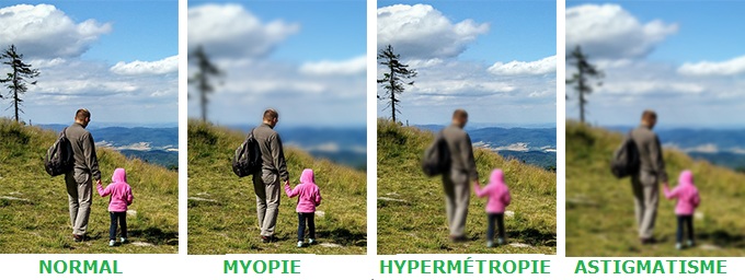 Image perçues selon le type de vice de réfraction