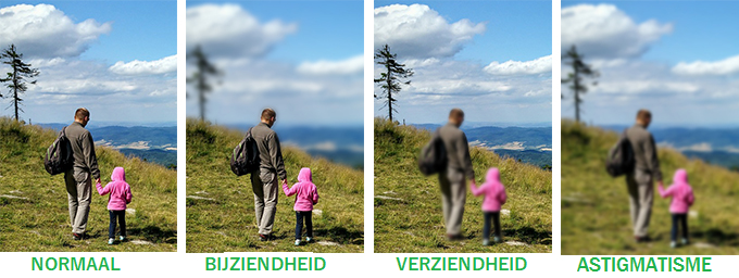 beeld met verschillend refractieafwijking 