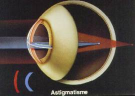 image perçue par un astigmate