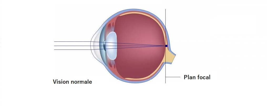 Développement normal de la vision