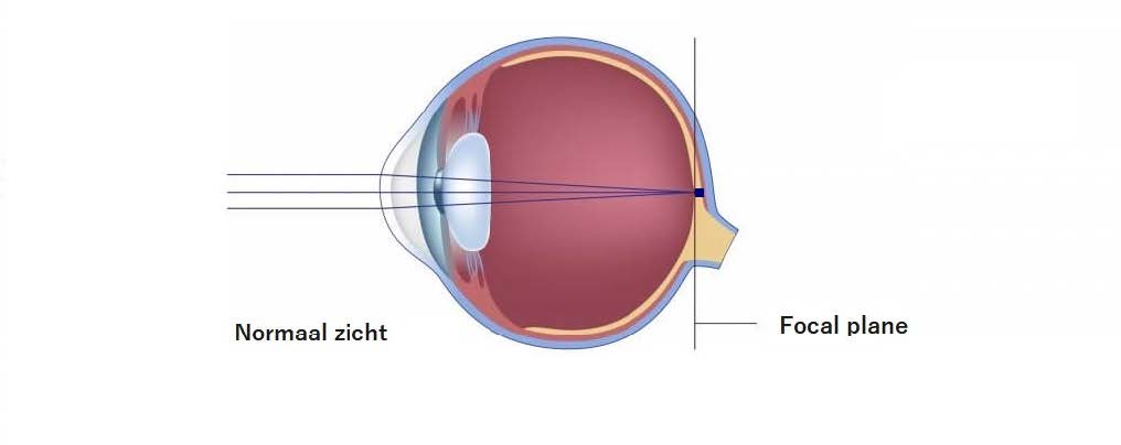 Normale visuele ontwikkeling
