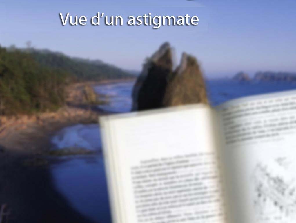 L'astigmatisme